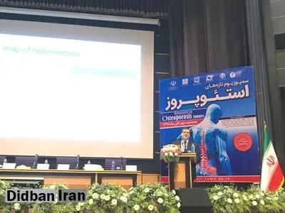 شیوع پوکی استخوان در نیمی از زنان بالای ۵۰ سال ایرانی