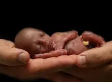 جزییات بسته ویژه خدمتی بیمه سلامت برای زوج‌های نابارور